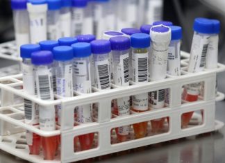 Bahia resgistra 8.881 casos confirmados de Covid-19 e 312 mortes