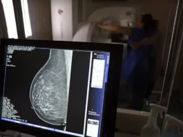 O que sua mamografia pode revelar sobre seu coração vai além do câncer