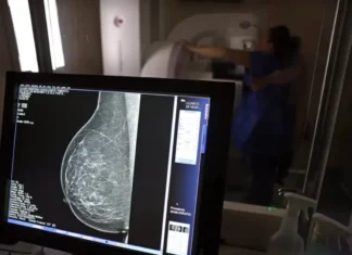 O que sua mamografia pode revelar sobre seu coração vai além do câncer