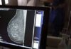 Carreta oferece mamografias gratuitas em Feira de Santana, Jequié e Alagoinhas
