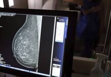 Carreta oferece mamografias gratuitas em Feira de Santana, Jequié e Alagoinhas