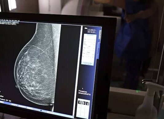 Carreta oferece mamografias gratuitas em Feira de Santana, Jequié e Alagoinhas